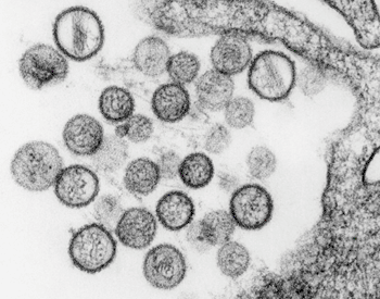 Image: transmission electron micrograph (TEM) of the Sin Nombre virus (Photo courtesy of Cynthia Goldsmith). 